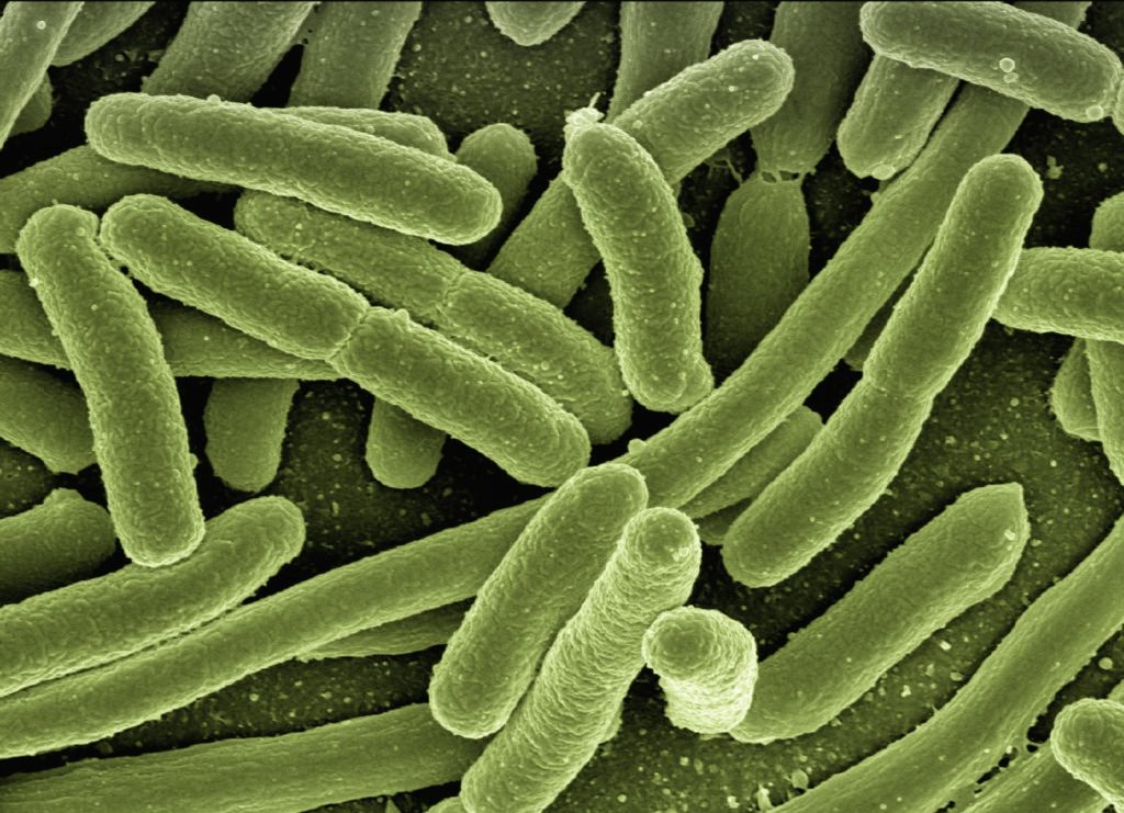 Green-tinted electron microscope image of rod-shaped bacteria clumped together, showing cylindrical bacilli.
